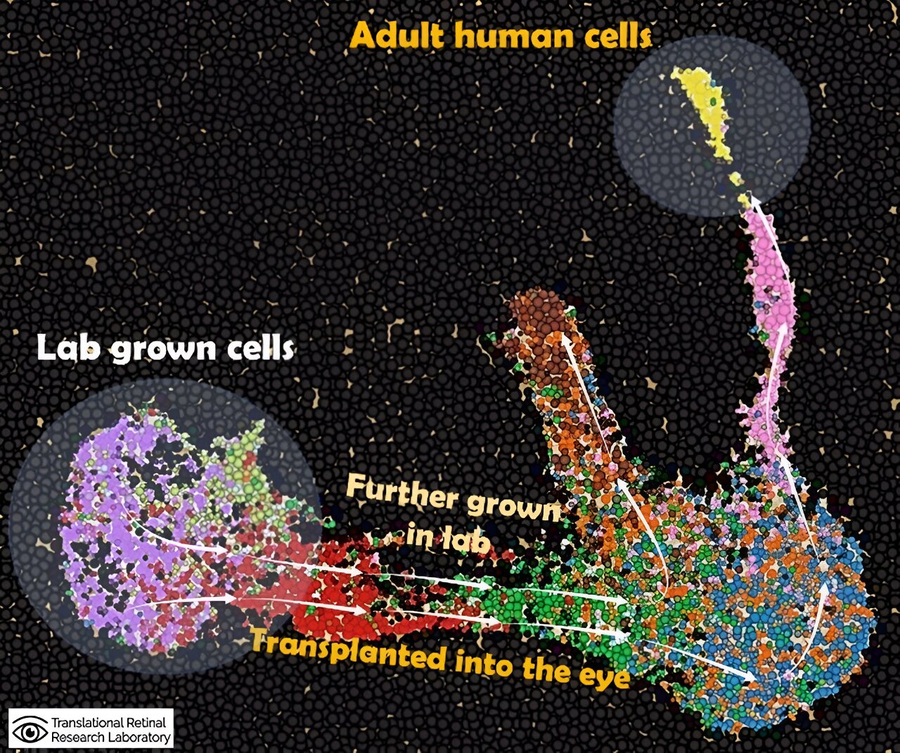 Singapore discovers novel insights into transplanted retinal cells to treat degenerative vision in elderly