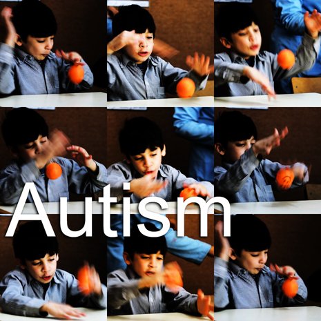 Autism spectrum disorder (ASD) and gastrointestinal disturbances (GID) are commonly co-occurring medical condition typically presents as diarrhea, constipation or reflux