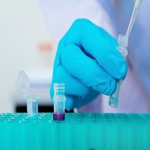 Novogen's drug shows positive result for brain cancer