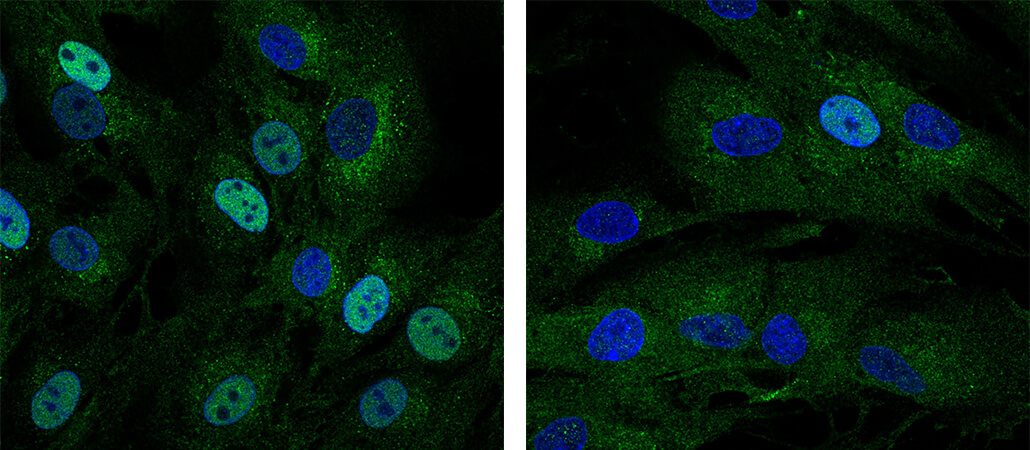 Singapore scientists discover immune pathway that causes immunodeficiency