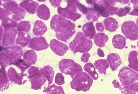 MiStat technology is capable of identifying the presence of a proprietary biomarker
