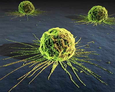 Prostrate cancer market update by GlobalData - Zytiga sales to be worth $1.7 billion in 2018 and Xtandi sales to rise to $2.05 billion by 2022