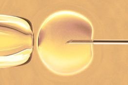 Renevia is an unique biomaterial that has as a delivery matrix and can be used as a vehicle for placing autologous adipose derived cells