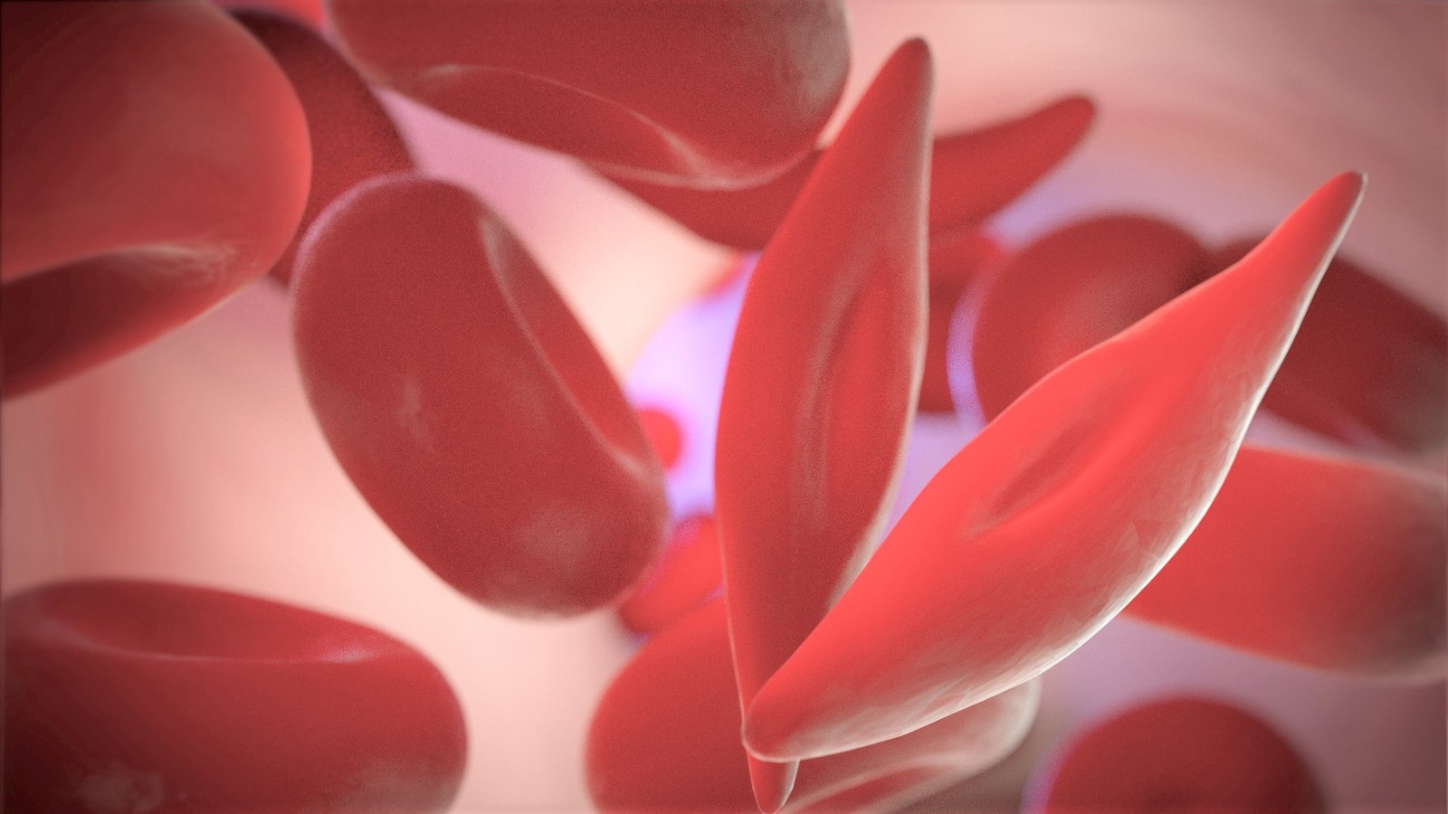 image courtesy: NIH
